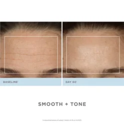 NuFACE Trinity Wrinkle Reducer (TWR) Attachment -Professional Care Product Stores 11395162 1424835717421978