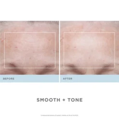 NuFACE Trinity Wrinkle Reducer (TWR) Attachment -Professional Care Product Stores 11395162 5864835717380527