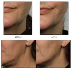 NuFACE Trinity Facial Toning Device -Professional Care Product Stores 11524131 6214875697465107