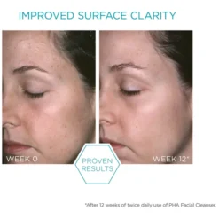 Neostrata Restore Facial Cleanser Gel With PHAs 200ml -Professional Care Product Stores 12052780 1464928009600847