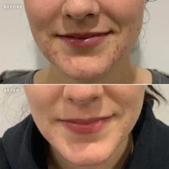 Alpha-H Clear Skin Tonic 100ml 11 Alpha-H Clear Skin Tonic 100ml -Professional Care Product Stores 12183424 1064939987422186