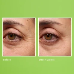 Murad Retinol Youth Renewal Eye Serum 15ml -Professional Care Product Stores 12453085 9394748381436012