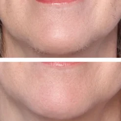 Hollywood Smoother Rose Gold - Exclusive -Professional Care Product Stores 12458471 1204900819148553