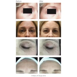 Rio FaceLite Beauty Boosting LED Face Mask -Professional Care Product Stores 12488222 1744779240029502