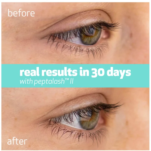 Indeed Labs Peptalash II 0.6ml 4 Indeed Labs Peptalash II 0.6ml - Image 2