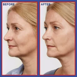 L'Oréal Paris Pure Retinol Revitalift Laser Night Serum 30ml -Professional Care Product Stores 12765069 6924846146573444