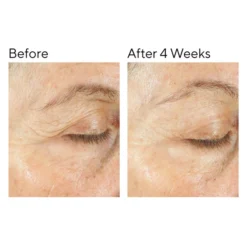 Murad Intense Recovery Cream 50ml -Professional Care Product Stores 12785718 4764839366015510