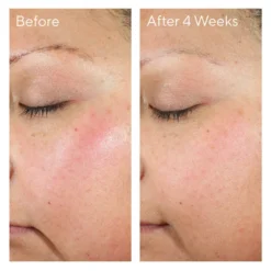 Murad Intense Recovery Cream 50ml -Professional Care Product Stores 12785718 6904839366128001