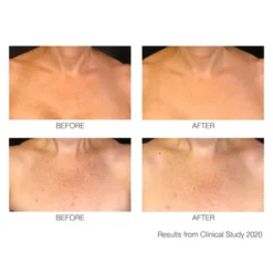 Rio DécoLITE Beauty Boosting Light Treatment 11 Rio DécoLITE Beauty Boosting Light Treatment -Professional Care Product Stores 12866753 1604838662968474