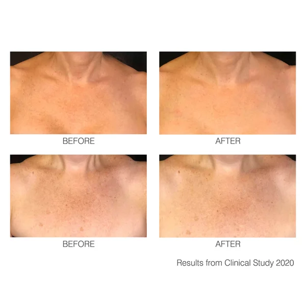 Rio DécoLITE Beauty Boosting Light Treatment 6 Rio DécoLITE Beauty Boosting Light Treatment - Image 4