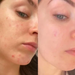 Revive Collagen Premium Liquid Hydrolysed Marine Collagen Drink - 14 Sachets -Professional Care Product Stores 13106842 7645000381594568