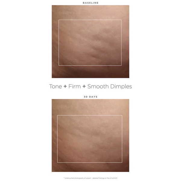 NuBODY By NuFACE 8 NuBODY By NuFACE - Image 6