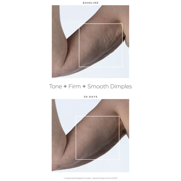 NuBODY By NuFACE 5 NuBODY By NuFACE - Image 3