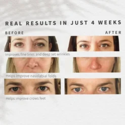 Sensse Professional LED Face Mask -Professional Care Product Stores 13521558 6864936828481025