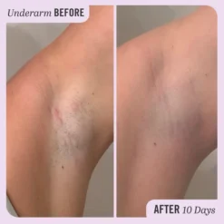 First Aid Beauty Ingrown Hair Treatment Pads (28 Pads) -Professional Care Product Stores 13522060 8124926203747460