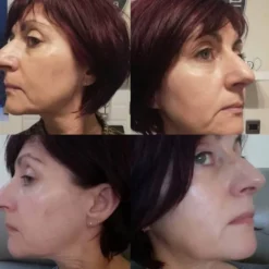 MAGNITONE London LiftOff - Grey -Professional Care Product Stores 13667916 1584948974722538