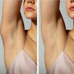 FOREO PEACH 2 Device - Peach -Professional Care Product Stores 14609036 5245049334476561